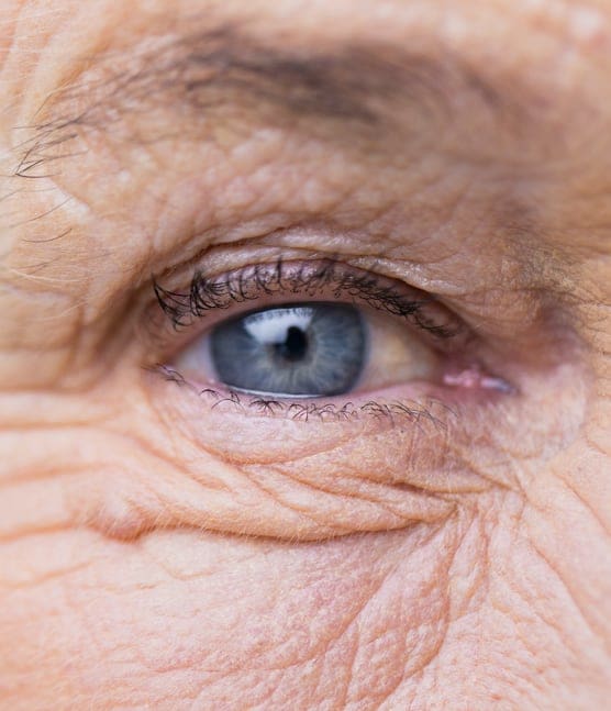 Cataract Surgery Specialist