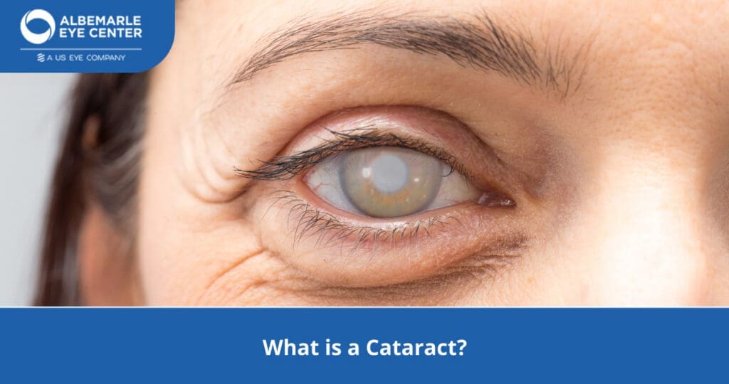 What is a Cataract