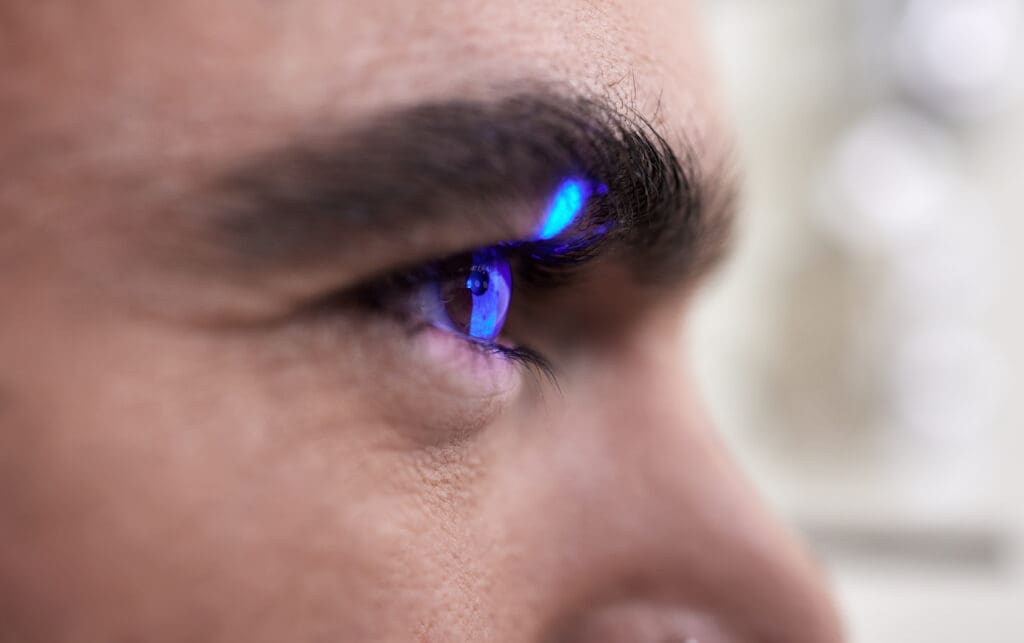 How Laser Eye Treatment Works