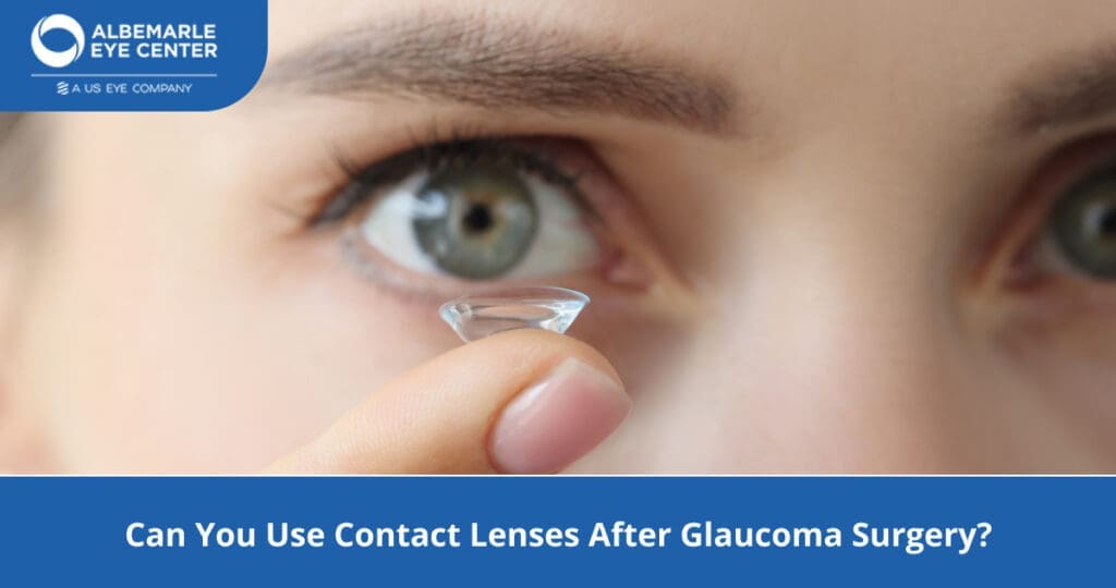 Contact Lenses After Glaucoma Surgery