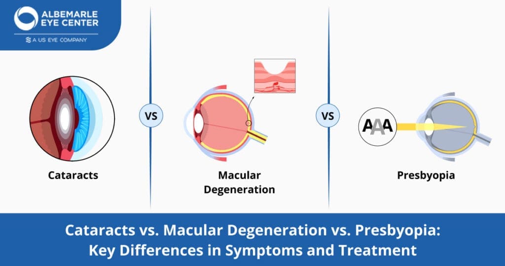 Cataracts Macular - Degeneration - Presbyopia Key Differences in Symptoms and Treatment